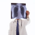 Un médico observa una radiografia de unos pulmones