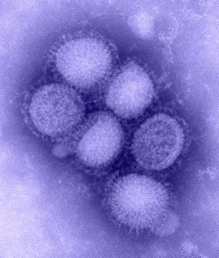 Imagen del virus de la Gripe A. Autor: CDC